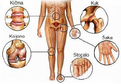 Vakuum se može masirati kod kuće: borimo se protiv dodatnih centimetara